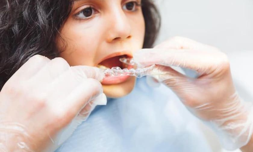 Everything Parents Need to Know About Pediatric Teen Invisalign Treatment