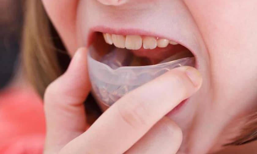 How To Wear A Mouth Guard Correctly For The Best Protection